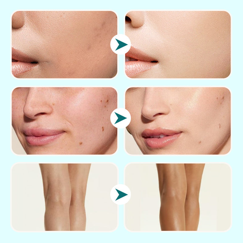 ✨Hydraterende concealer, waterbestendige crème voor vrouwen🔥50% korting - alleen vandaag